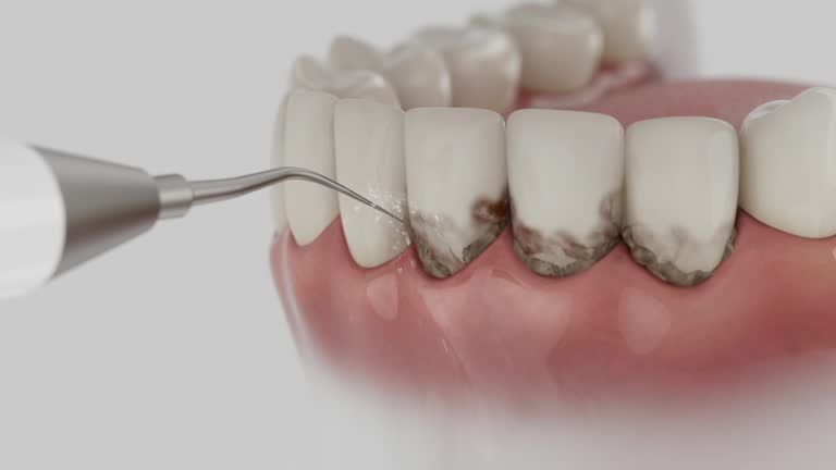 Reliable Dental Implants contractor in Olive Branch, MS by Smile Center Dentistry